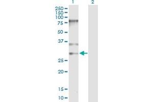 Western Blot analysis of SNRPB expression in transfected 293T cell line by SNRPB MaxPab polyclonal antibody. (SNRPB Antikörper  (AA 1-240))