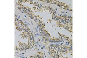 Immunohistochemistry of paraffin-embedded human prostate using EIF4B Antibody. (EIF4B Antikörper)