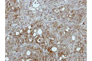 Immunohistochemistry (IHC) image for anti-Pyruvate Kinase (PK) (Center) antibody (ABIN2856815)