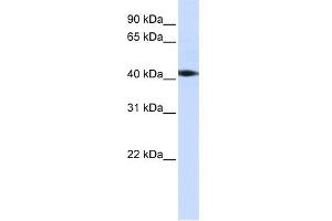 WB Suggested Anti-STK17A Antibody Titration:  0. (STK17A Antikörper  (C-Term))