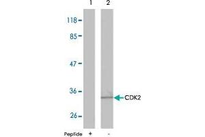 Western blot analysis of extracts from A2780 cells using CDK2 polyclonal antibody  . (CDK2 Antikörper)