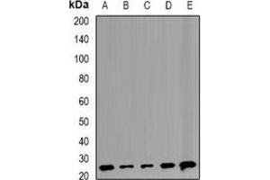 Western blot analysis of TMP21 expression in Raji (A), Hela (B), MCF7 (C), mouse liver (D), rat lung (E) whole cell lysates.