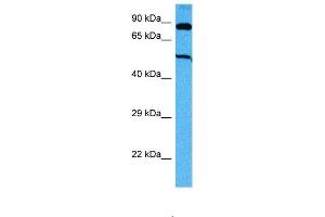 Host:  Mouse  Target Name:  SUFU  Sample Tissue:  Mouse Skeletal Muscle  Antibody Dilution:  1ug/ml (SUFUH Antikörper  (Middle Region))