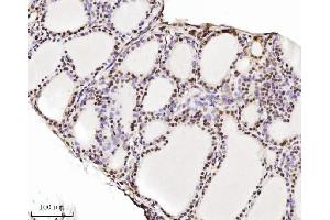 IHC analysis of TRIM24 using anti-TRIM24 antibody (ABIN7602358).