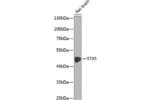 Western blot analysis of extracts of Rat brain using STX5 Polyclonal Antibody at dilution of 1:1000. (Syntaxin 5 Antikörper)