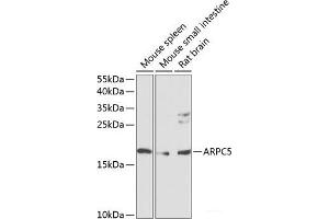 Western blot analysis of extracts of various cell lines using ARPC5 Polyclonal Antibody at dilution of 1:1000. (ARPC5 Antikörper)