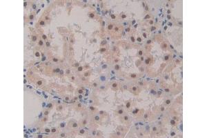Used in DAB staining on fromalin fixed paraffin- embedded Kidney tissue (POLA1 Antikörper  (AA 1240-1462))