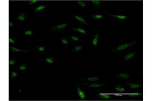 Immunofluorescence of monoclonal antibody to HMX2 on HeLa cell. (HMX2 Antikörper  (AA 125-224))