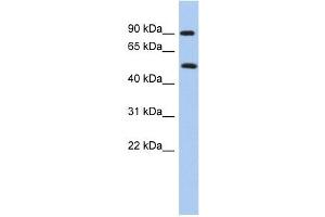 PRMT7 antibody used at 1 ug/ml to detect target protein. (PRMT7 Antikörper  (N-Term))