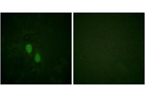 Immunofluorescence analysis of HeLa cells, using hnRPD Antibody . (HNRNPD/AUF1 Antikörper)