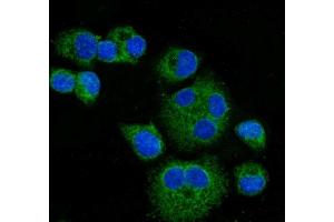 IF analysis of CPT1A using anti-CPT1A antibody (ABIN7599853). (CPT1A Antikörper  (AA 122-556))