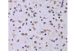 Immunohistochemistry of paraffin-embedded Rat brain using NUDC Polyclonal Antibody at dilution of 1:100 (40x lens).
