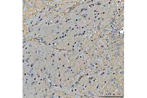 IHC analysis of TIGD1 using anti-TIGD1 antibody (ABIN7602407). (TIGD1 Antikörper  (AA 74-591))