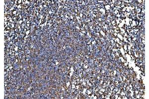 IHC analysis of RPL32 using anti-RPL32 antibody (ABIN7601826).