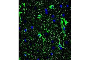 Confocal immunofluorescent analysis of GF Antibody (ABIN659067 and ABIN2838068) with brain tissue followed by Alexa Fluor® 488-conjugated goat anti-mouse lgG (green). (GFAP Antikörper)