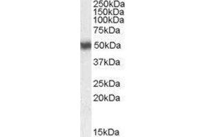 Western Blotting (WB) image for Retinoic Acid Receptor, alpha (RARA) peptide (ABIN369917) (Retinoic Acid Receptor, alpha (RARA) Peptid)