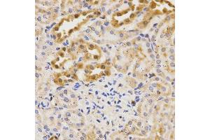 Immunohistochemistry (IHC) image for anti-ATG5 Autophagy Related 5 (ATG5) (AA 1-275) antibody (ABIN3020674)