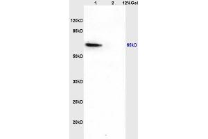 Lane 1: rat brain lysates Lane 2: rat liver lysates probed with Anti CDKAL1 Polyclonal Antibody, Unconjugated (ABIN873056) at 1:200 in 4 °C.