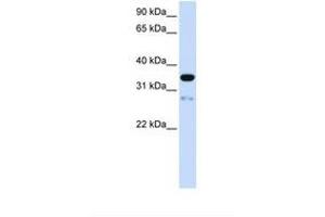 Image no. 1 for anti-Transmembrane Protein 38A (TMEM38A) (AA 74-123) antibody (ABIN6738623) (TMEM38A Antikörper  (AA 74-123))