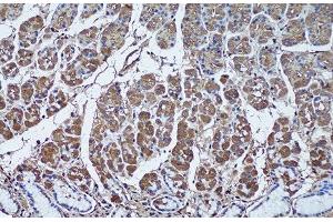 Immunohistochemistry of paraffin-embedded Human stomach using SFRP1 Polyclonal Antibody at dilution of 1:50 (20x lens). (SFRP1 Antikörper)