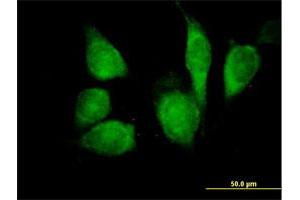 Immunofluorescence of purified MaxPab antibody to CDKN1B on HeLa cell. (CDKN1B Antikörper  (AA 1-198))