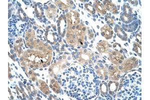 TLR6 antibody was used for immunohistochemistry at a concentration of 4-8 ug/ml to stain Epithelial cells of renal tubule (arrows) in Human Kidney.