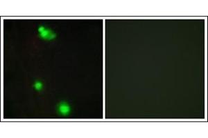 Immunofluorescence analysis of MCF7 cells, using SFRS3 Antibody. (SRSF3 Antikörper  (C-Term))