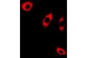 Immunofluorescent analysis of ANXA8L2 staining in A549 cells. (ANXA8L2 Antikörper)