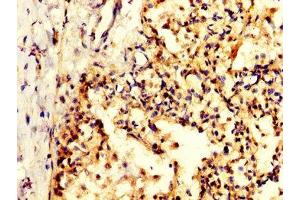 IHC image of ABIN7156276 diluted at 1:200 and staining in paraffin-embedded human lung tissue performed on a Leica BondTM system. (Pyrophosphatase (Inorganic) 1 (PPA1) (AA 59-173) Antikörper)