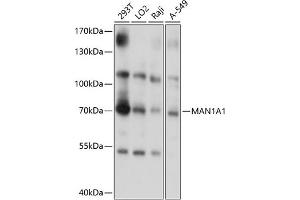 Western blot analysis of extracts of various cell lines, using M antibody (0830) at 1:1000 dilution. (MAN1A1 Antikörper  (AA 70-190))