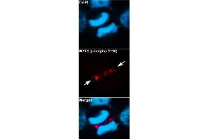 Immunofluorescent staining of methanol-fixed U87 cells using MYL2 (phospho Y118) polyclonal antibody  at 1:100-1:200 dilution. (MYL2 Antikörper  (pTyr118))