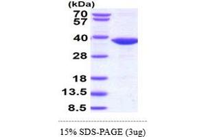 SDS-PAGE (SDS) image for Heterogeneous Nuclear Ribonucleoprotein K (HNRNPK) (AA 1-276) protein (His tag) (ABIN5853065)
