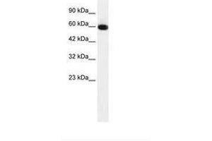 Image no. 1 for anti-GLIS Family Zinc Finger 2 (GLIS2) (AA 183-232) antibody (ABIN6735915) (GLIS2 Antikörper  (AA 183-232))