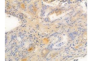 anti-Fc Receptor-Like 4 (FCRL4) (C-Term) antibody