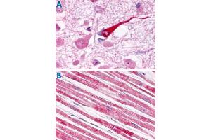Immunohistochemistry (Formalin/PFA-fixed paraffin-embedded sections) of human brain (A) and human heart tissue (B) with GALR1 polyclonal antibody . (Galanin Receptor 1 Antikörper  (Extracellular Domain))