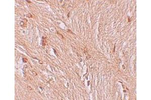 Immunohistochemistry (IHC) image for anti-Zinc Finger and BTB Domain Containing 3 (ZBTB3) (C-Term) antibody (ABIN1030811) (ZBTB3 Antikörper  (C-Term))