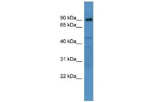 WB Suggested Anti-Adam22 Antibody Titration:  0.