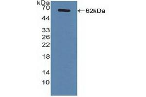 Detection of Recombinant FXR, Human using Polyclonal Antibody to Farnesoid X Receptor (FXR) (NR1H4 Antikörper  (AA 211-486))
