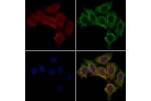 KC1AL Antibody staining HepG2 cells by IF/ICC. (CSNK1A1L Antikörper  (C-Term))