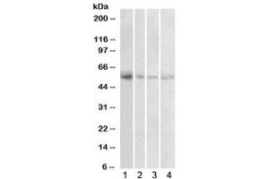 Western blot testing of human 1) placenta, 2) uterus, 3) adrenal gland and 4) pancreas lysate with VMAT2 antibody at 1ug/ml. (SLC18A2 Antikörper)