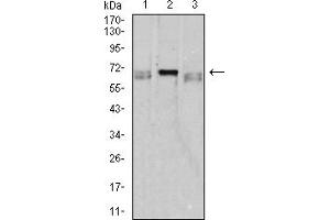 Western blot analysis using CD42B mouse mAb against K562 (1), HL-60 (2), and Ramos (3) cell lysate. (CD42b Antikörper  (AA 17-183))