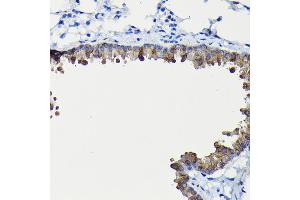 Immunohistochemistry of paraffin-embedded mouse lung using FUC Rabbit pAb (ABIN6127916, ABIN6140809, ABIN6140811 and ABIN6215812) at dilution of 1:200 (40x lens).