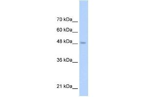 WB Suggested Anti-TLR6 Antibody Titration: 0. (TLR6 Antikörper  (Middle Region))