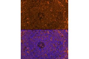 Immunofluorescence analysis of Rat spleen using FB antibody (ABIN6129339, ABIN6140465, ABIN6140466 and ABIN6224941) at dilution of 1:100. (FAM65B Antikörper  (AA 1-210))