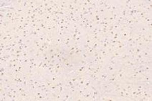 Immunohistochemistry analysis of paraffin-embedded mouse substantia nigra using UBLCP1 (ABIN7076132) at dilution of 1: 4200 (UBLCP1 Antikörper)
