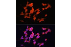 Immunofluorescence analysis of SH-SY5Y cells using EL Rabbit pAb (ABIN6134651, ABIN6140118, ABIN6140119 and ABIN6221704) at dilution of 1:100 (40x lens).