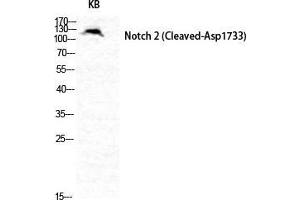 Western Blot (WB) analysis of specific cells using Cleaved-Notch 2 (D1733) Polyclonal Antibody.