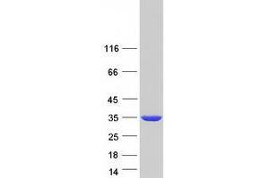 Validation with Western Blot (SULT1A2 Protein (Transcript Variant 1) (Myc-DYKDDDDK Tag))