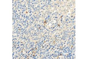 IHC analysis of TLR1 using anti-TLR1 antibody (ABIN7602194).