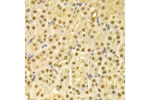 Immunohistochemistry of paraffin-embedded mouse kidney using CDC25A antibody (ABIN5970519) at dilution of 1/100 (40x lens). (CDC25A Antikörper)